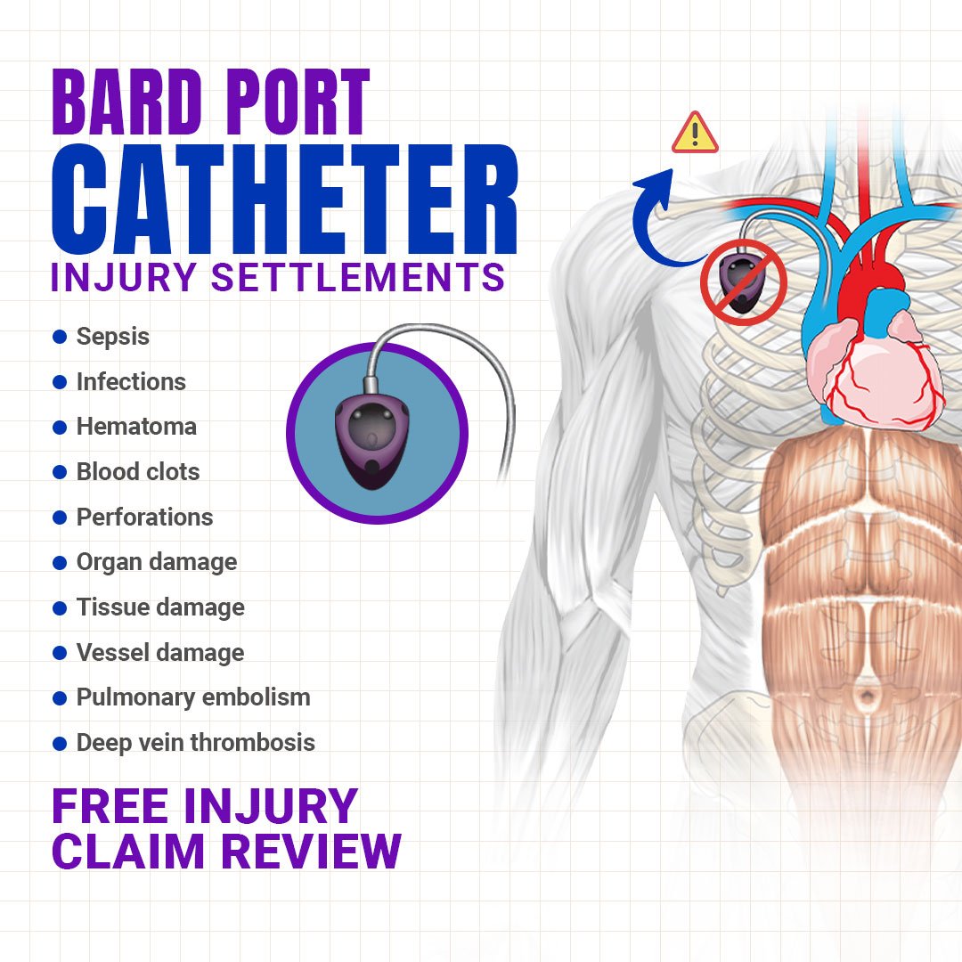 Top quality Bard PowerPort leads, TIVAD leads, and Bard PowerPort retainer leads for personal injury and mass tort attorneys.